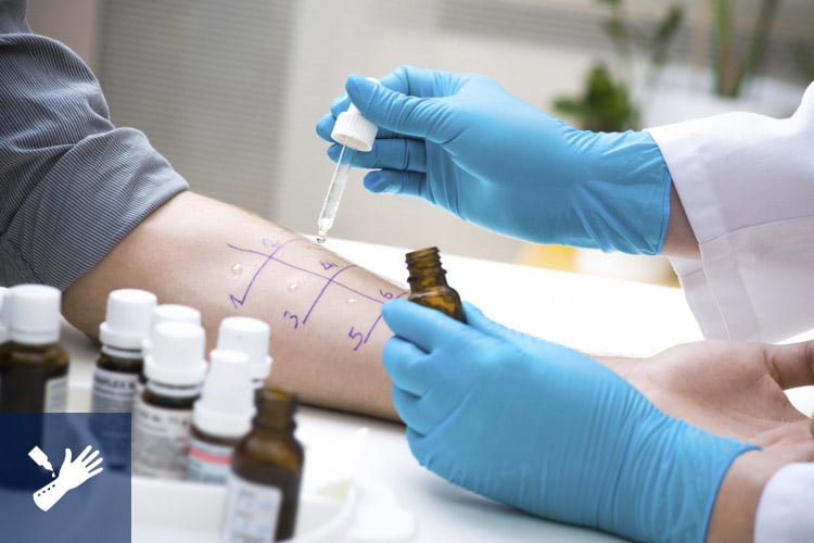 allergy-testing